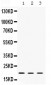 Anti-Cofilin 2 Antibody