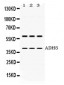 Anti-ADH5 Antibody