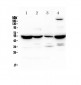 Anti-Adenylosuccinate Lyase Picoband Antibody