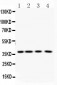 Anti-PNP Picoband Antibody