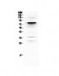 Anti-Complement C9 Picoband Antibody