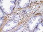 Anti-VEGF Receptor 3 Picoband Antibody
