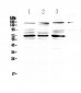 Anti-IL17RA Antibody