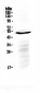 Anti-IL6R Picoband Antibody