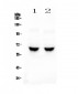 Anti-GAD65 Picoband Antibody