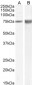 Goat Anti-JIP1 / MAPK8IP1 Antibody 