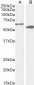 Goat Anti-Cyp2r1 (mouse aa405-418)) Antibody