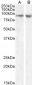 Goat Anti-FBXO11 (aa754-765) Antibody 