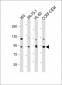 MMP9 Antibody