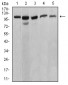 ATP2A1