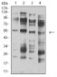 CHRNA5