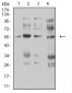 CHRNA5