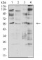 CHRNA2