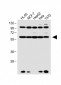 RARA Antibody (C-term)