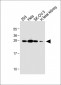 TGIF2 Antibody (C-term)