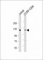 GLI2 Antibody (C-term)