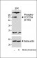 Phospho-CDC25A(S124) Antibody