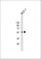 CYP27B1 Antibody (C-term)