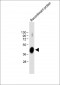 ADAMTS4 Antibody