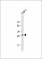 CDCA8 Antibody (Center)