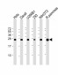 RPL10 Antibody (N-term)