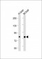 ABCG1 Antibody (N-term)