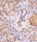 VHL Antibody (N-term)