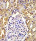 VHL Antibody (N-term)