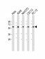 Pyruvate Kinase (PKM2) Antibody (C-term)