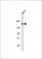 PRDM10 Antibody