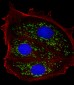 TFF1 Antibody (Center)