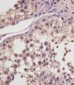 MGEA5 Antibody (N-Term)