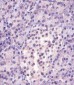 MGEA5 Antibody (N-Term)