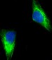 MUT Antibody (Center)