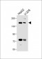 ABCB4 Antibody (Center)