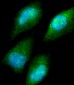 CBS Antibody (Center)