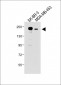 ERBB2 Antibody