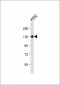 ITGA8 Antibody (C-term)