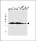 RAB1B Antibody (C-term)