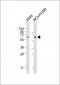 SQSTM1 Antibody