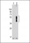 PDCD1LG2 Antibody (N-term)