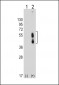 PDCD1LG2 Antibody (N-term)