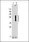 PDCD1LG2 Antibody (N-term)