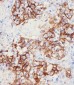 PD L1 Monoclonal  Antibody (PDL1)