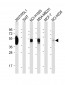 PD L1 Monoclonal  Antibody (PDL1)