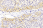 PD L1 Monoclonal  Antibody (PDL1)