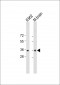 CAB39 Antibody