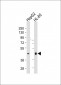 HLA-F Antibody