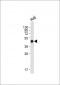 HLA-F Antibody