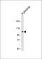 GAA Antibody (N-term)